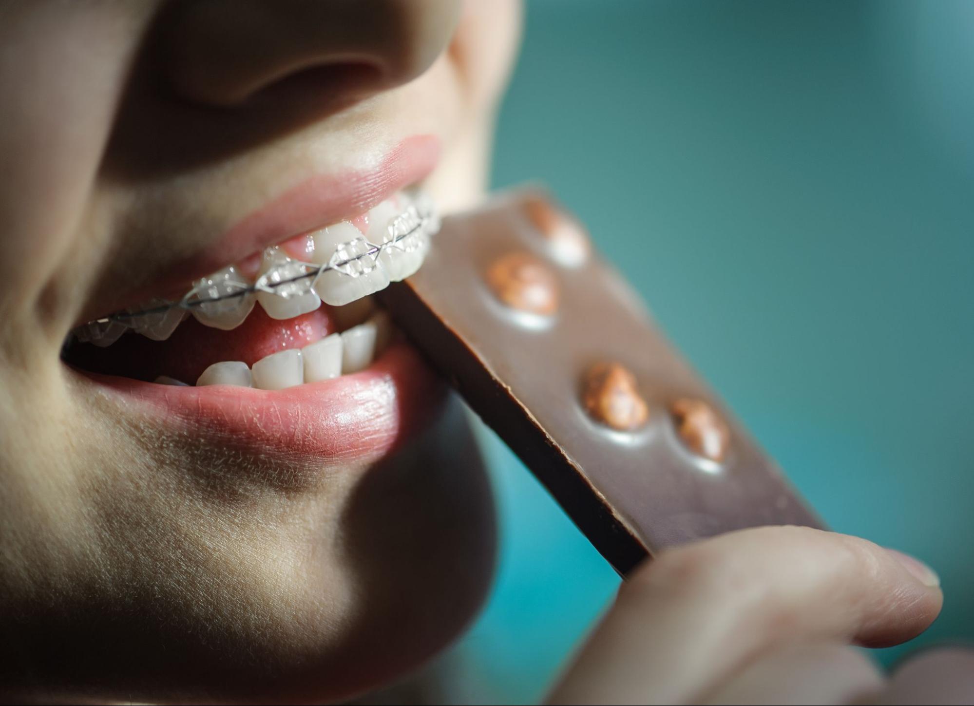 5 Foods To Avoid With Braces In Winter Haven