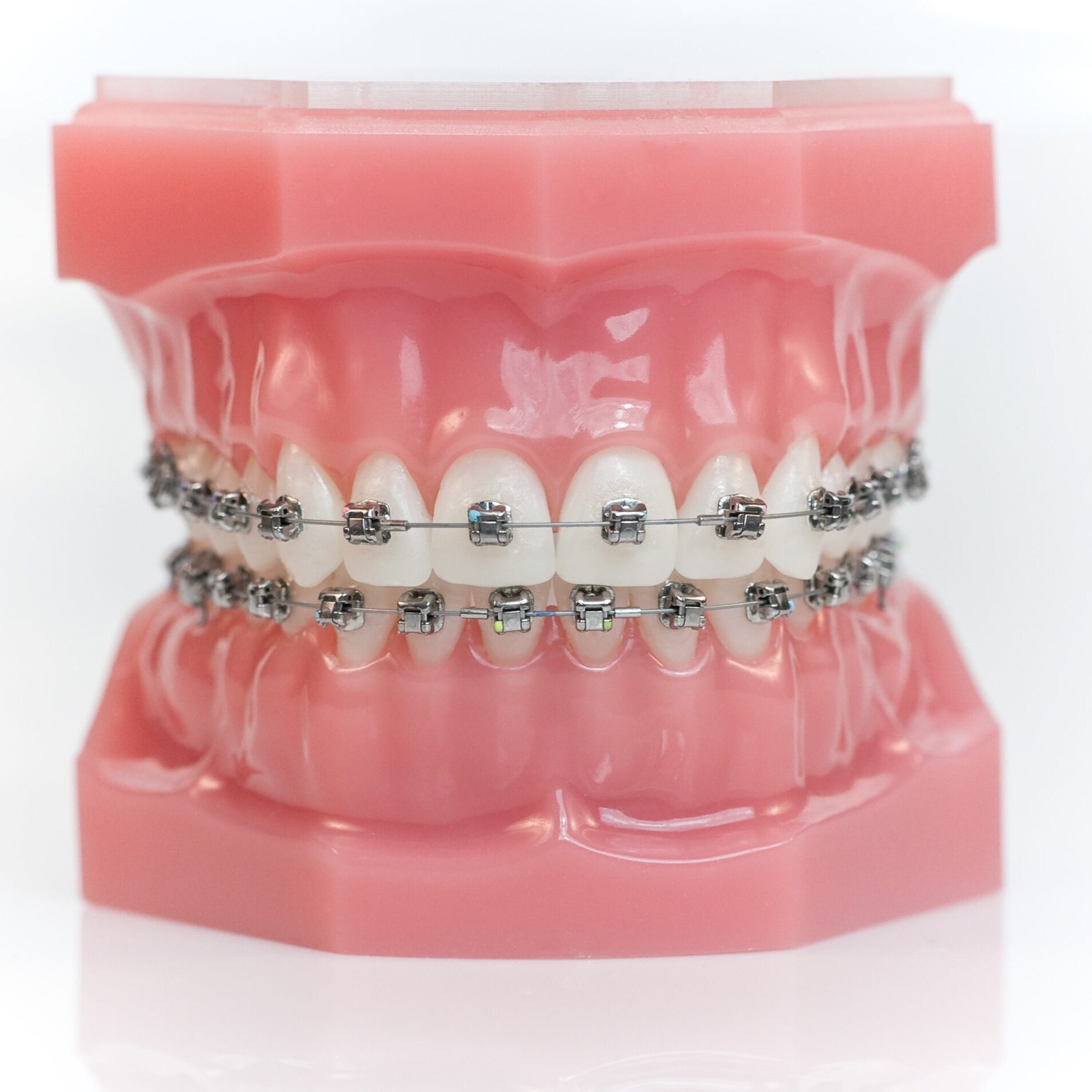 orthodontist lakeland fl