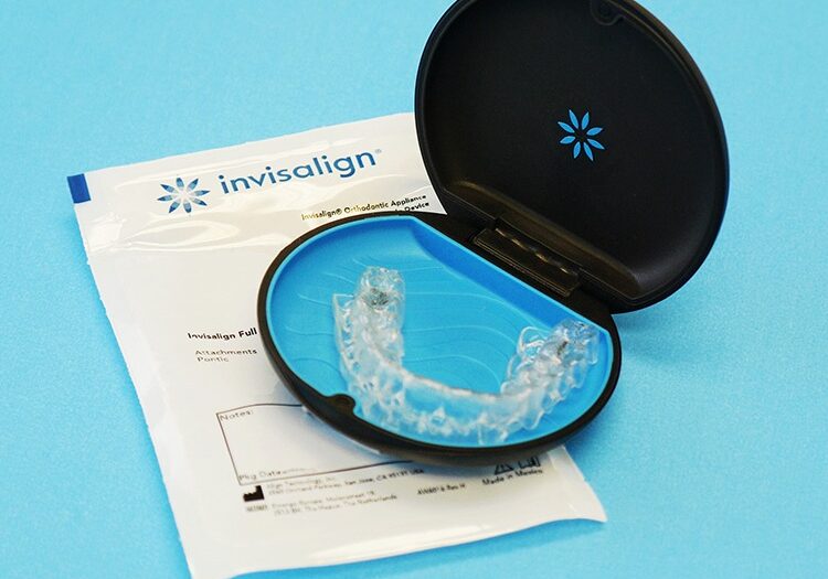 invisalign-step-2